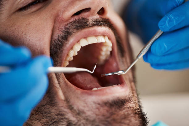Best Emergency Tooth Extraction in Big Stone Gap, VA